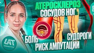 Боль, судороги, риск ампутации: как лечить атеросклероз сосудов ног?