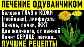 ОДУВАНЧИК: ЛЕЧЕБНЫЕ свойства корня, листьев, цветов РЕЦЕПТЫ. Для печени, глаз, ПОЧЕК, СЕРДЦА Желудка