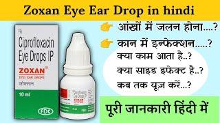 Zoxan eye ear drop uses | price | composition | dose | side effects | review | in hindi MR