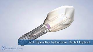 Post-Operative Instructions: Dental Implants