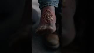 Worms in the leg #gooddoctor #shorts #highlights #hospital