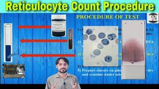 Reticulocyte Counting Procedure