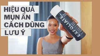 BHA Paula's Choice | Cách dùng BHA, mụn ẩn, giải đáp thắc mắc, review,..