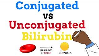 Conjugated vs Unconjugated Bilirubin - Simple Explanation