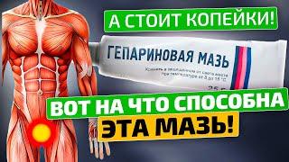 Вот все способы применения Гепариновой мази, о которых вы не знали!