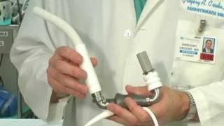 Left Ventricular Assist Device - LVAD Procedure