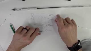 Wire bending 101 -  First and second order and intrusion bends