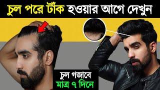 চুল পড়া বন্ধ ও নতুন চুল গজানোর উপায় | How To Grow Hair and Stop Hair Fall | Success Never End