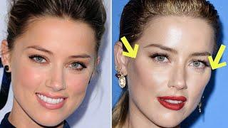 Amber Heard got cheek implants to look like Depp? | Opt into Beauty