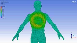 ANSYS. Kevlar armor vs bullet