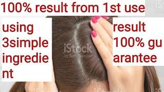 100% result for dandruff