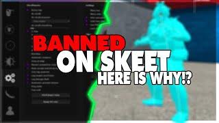 I'm Banned on SKEET (Gamesense) and here is why! | CS:GO HACKING