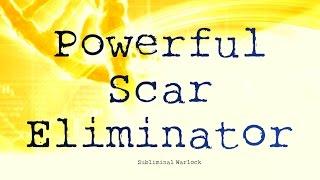 Remove Scars (Any Type) Subliminals Frequencies Hypnosis Rife Biokinesis Binaural Beats