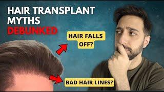 Debunking 7 Common MYTHS about a Hair Transplant