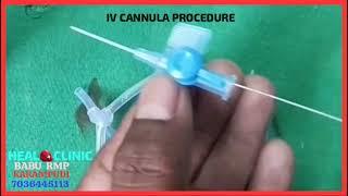 IV CANNULA PROCEDURE. BABU KARAMPUDI heal clinic