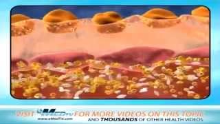 Diabetes symptoms in children
