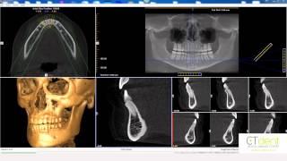 CT Dent i-CAT Vision Basic Navigation