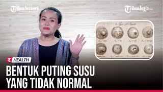  BAGAIMANA BENTUK PUTING SUSU YANG TIDAK NORMAL ?