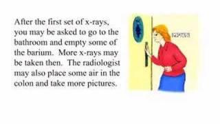 Barium Enema