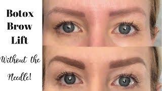 Get The Look Of A BOTOX BROW LIFT Using Makeup | Full Eyebrow Tutorial