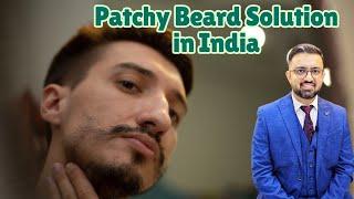 Patchy Beard Fix in India FAST!  | Best Treatments by Top Surgeon