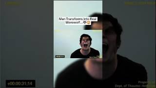  Man Transforms Into Real Werewolf ..️#shorts #youtube #shortsfeed #viralshorts #youtubeshorts