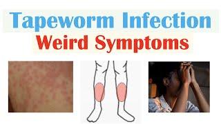 Weird Symptoms of Tapeworm Infection (Skin, Psychological, Neurological)