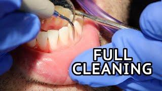 How Teeth Are Cleaned At The Dentist