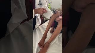 Deep tendon reflexes | knee jerk reflex #youtubeshorts#viral#pediatrics