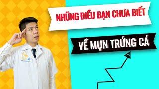 Mụn trứng cá và những điều bạn chưa biết|Treatment Acne| Dr Ngọc