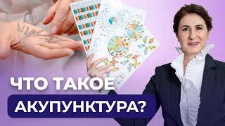 Что такое акупунктура простыми словами? Лечение иглоукалыванием