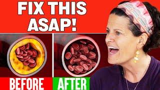 The Best Foods To Clear Out Your Arteries | Dr. Mindy Pelz