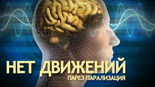 ПАРЕЗ, ПАРАЛИЗАЦИЯ Почему нет движений? Можно их вернуть.