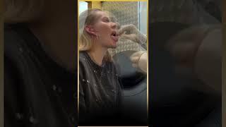 Let´s get a -Piercing #piercingstudiowien #piercingstudio #tonguepiercing #piercedgirl