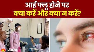 Eye Flu: आई फ्लू होने पर क्या करें और क्या न करें? जानें बचाव के तरीके। Conjunctivitis