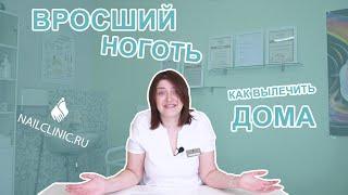 Вросший ноготь на ноге. Лечение вросшего ногтя в домашних условиях.