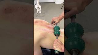 LOUD *CRACKS*  Steamrolling A Tight Back!! #shorts #chiropractor