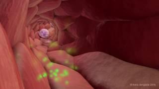 Extravasation of Neutrophils