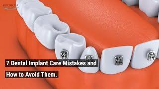 7 Dental Implant Care Mistakes and How to Avoid Them
