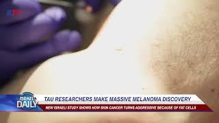 TAU Researchers Make Massive Melanoma Discovery - Your News From Israel