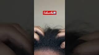 Full Head Scratching | ASMR Brain Scratching #itchyscalp #shorts