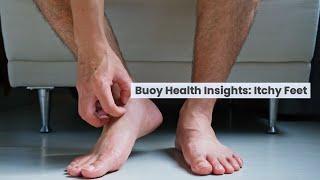 Itchy Feet: Common Causes and When to Seek Medical Care | BuoyHealth.com