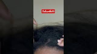 Fast & Aggressive | Satisfying Scalp Scratching #itchyscalp #asmr #shorts