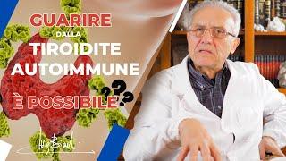 Si può guarire di TIROIDITE AUTOIMMUNE?