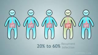 Fecal Microbial Transplantation: A Treatment for Clostridium Difficile