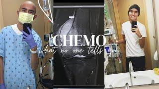 THIS is what NO ONE tells you about CHEMO