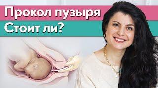 Как прокалывают околоплодный пузырь? | Что такое амниотомия?