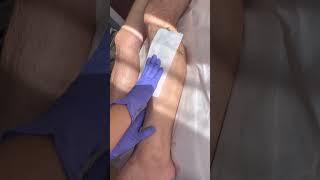 Male lower leg wax using waxup roll on wax kit #esthetician #waxing #hairremoval