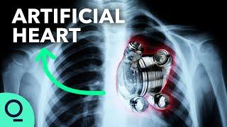 Permanent Artificial Hearts Are Closer Than You Think