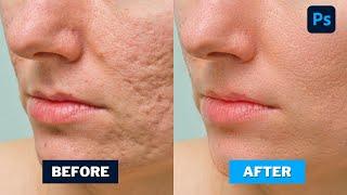 High end Skin Retouching Photoshop Tutorial - Creative Graphic Tv